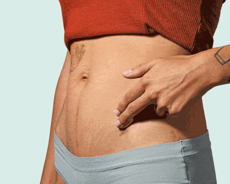 Person using Ladykind Tough Love Pain Relieving Cream on Stomach
